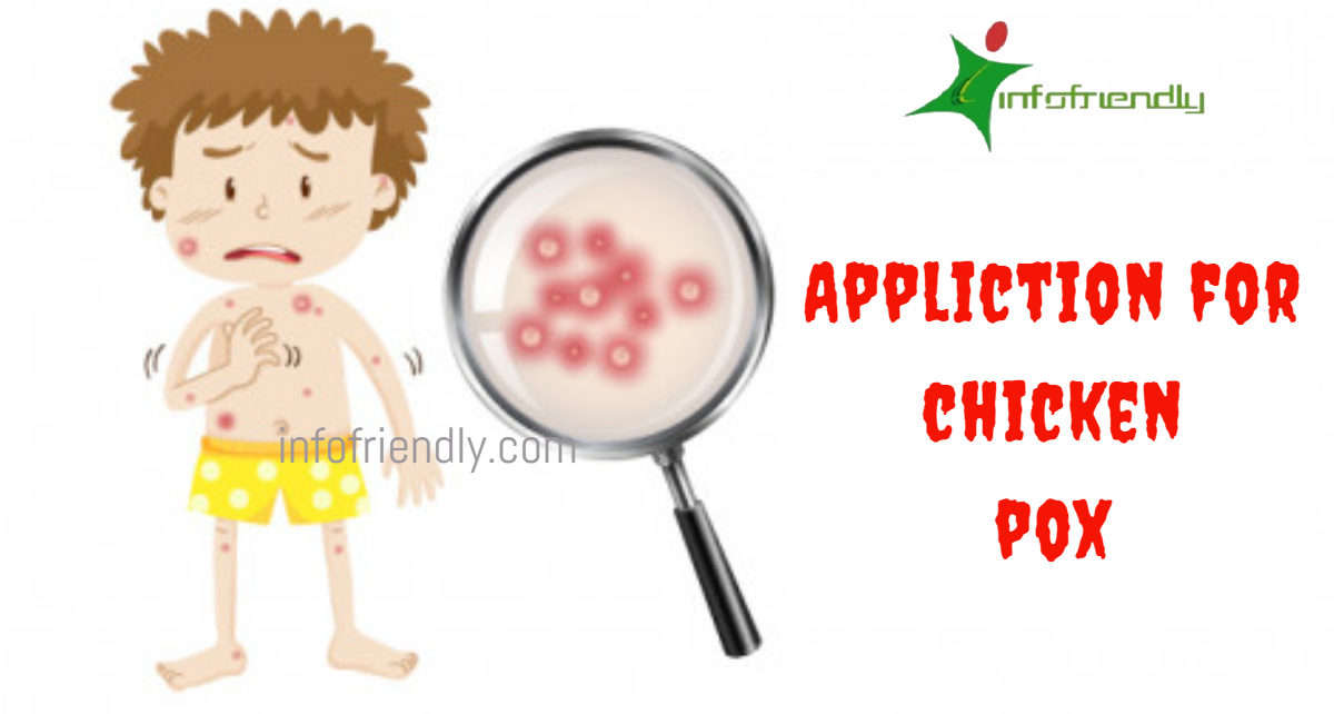 Write an application to your principal for Chicken pox leaves
